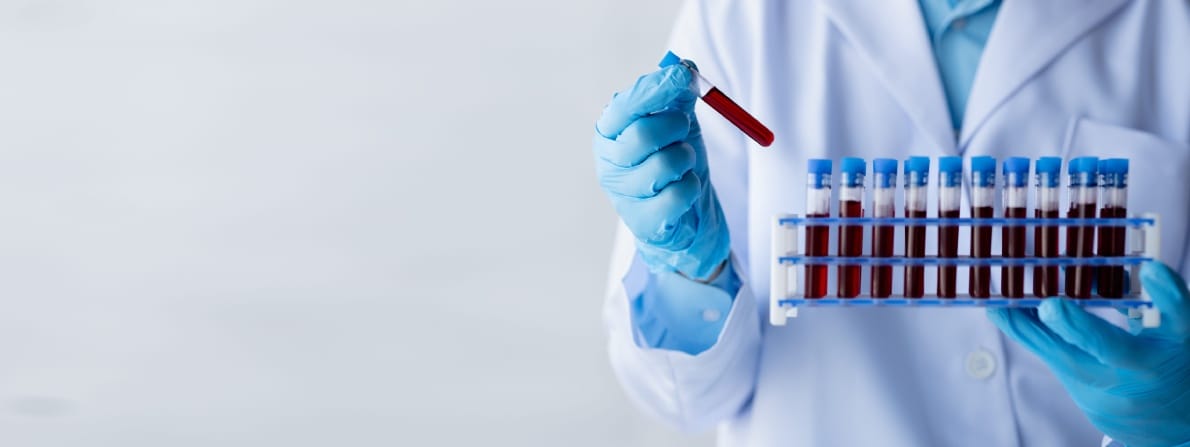 Un científico con una bata de laboratorio y guantes azules sostiene un tubo de ensayo de sangre y un estante de tubos similares, transportando una atmósfera clínica y analítica.